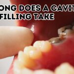 How Long Does a Cavity Filling Take