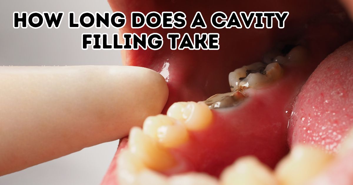 How Long Does a Cavity Filling Take